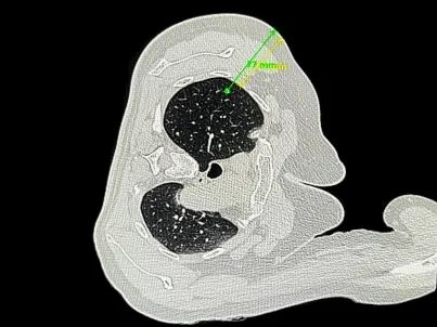 17401013358020.jpg 800CB749B11EBD31B39CA593EDA_69397A32_5BED.jpg